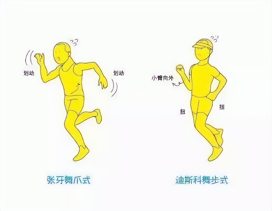 Correct running posture, warmup and selfrehabilitation training for