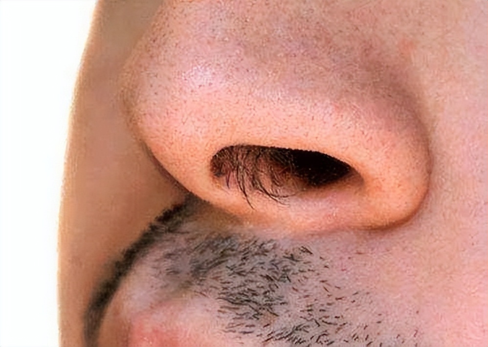 What's the difference between men with protruding nose hair?What does whitening nose hair mean?Read or gain knowledge - iNEWS What's the difference between men with protruding nose hair?What does whitening nose hair mean?Read or gain knowledge - iNEWS