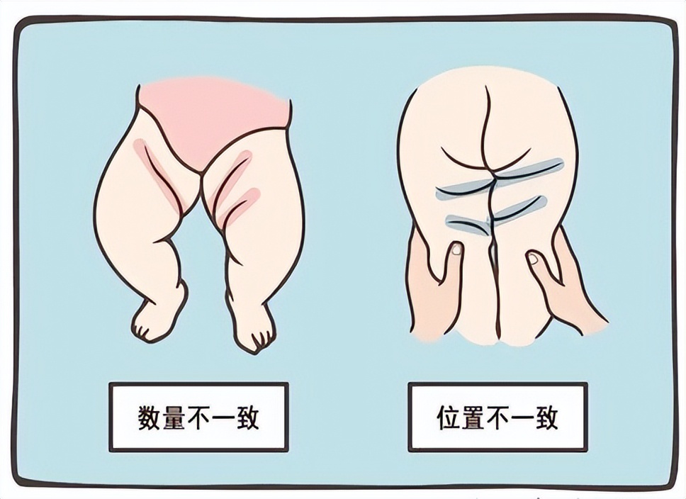 The baby's legs are asymmetrical, don't take it seriously, it may ...
