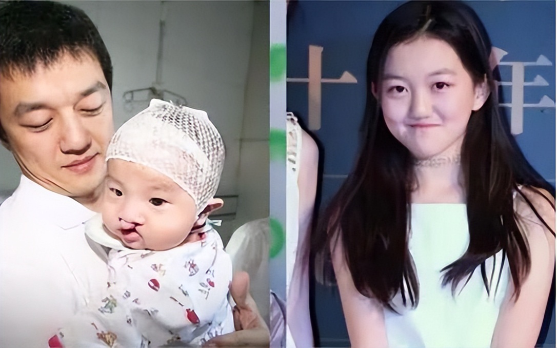 Li Yapeng's youngest daughter appeared in the hospital in serious ...