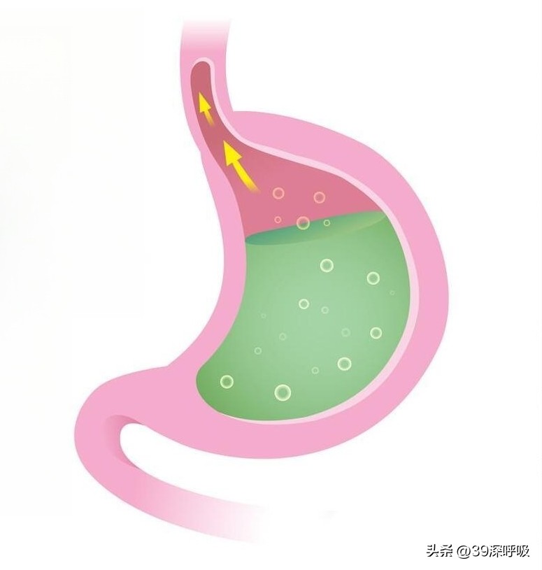 Chest pain after touching ginger and garlic iMedia