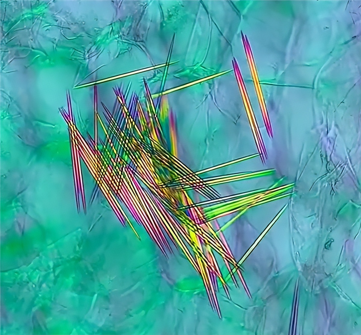 no-wonder-my-mouth-hurts-after-eating-pineapple-under-the-microscope