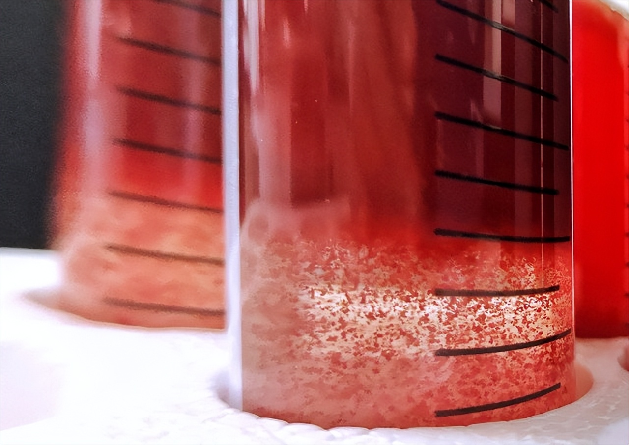 Sediment in Wine Know, Understand and Enjoy iMedia