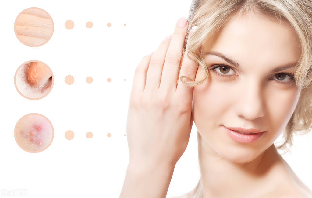 Shifan learns to remove acne dry goods!People with acneprone skin