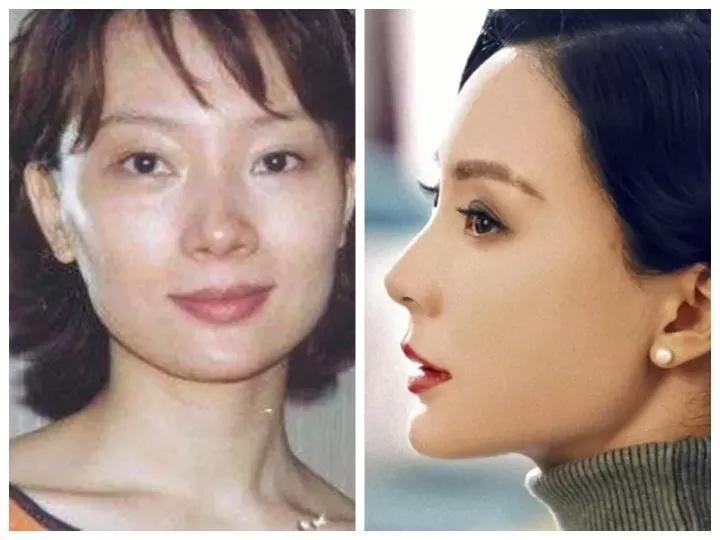 Is there a difference between "plastic surgery" and "no plastic surgery