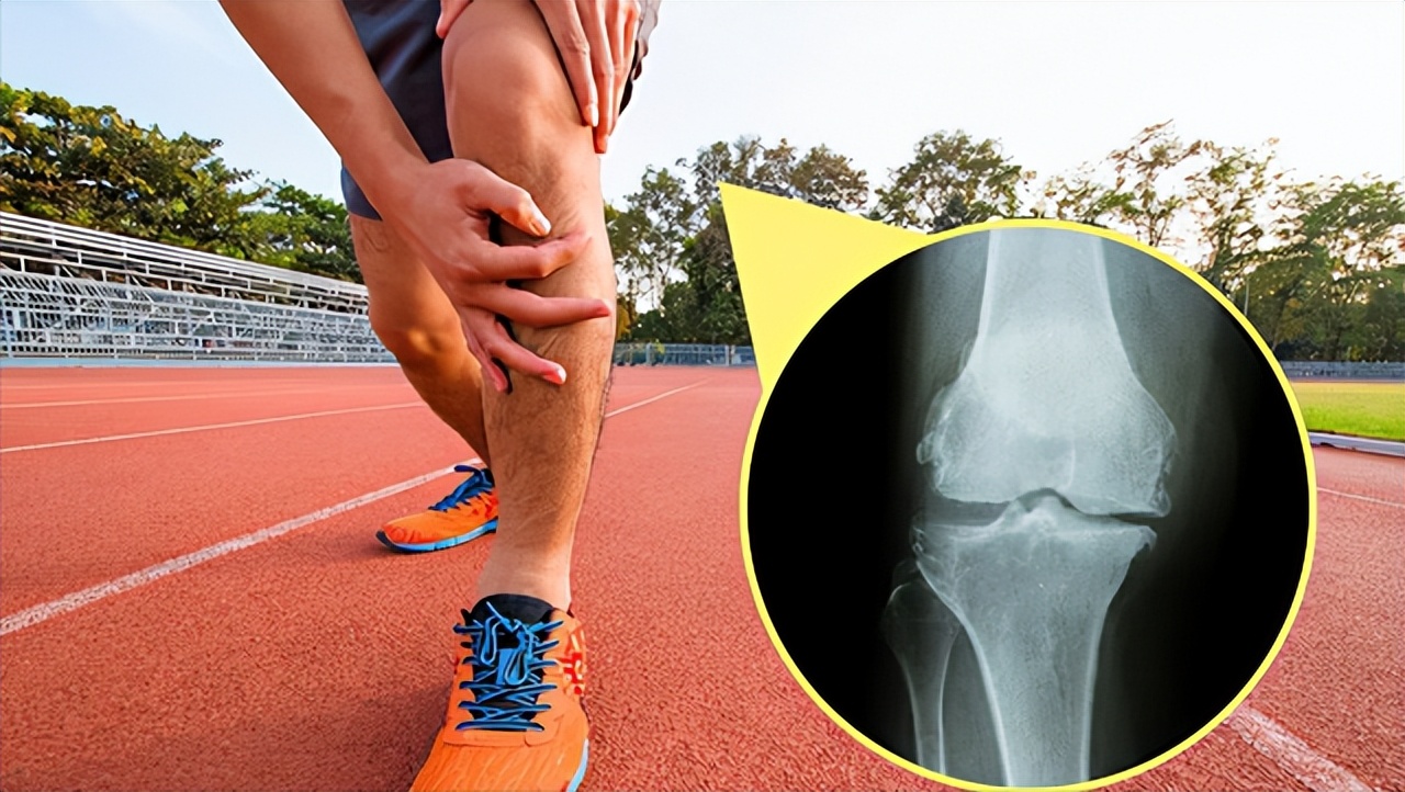 Knees suddenly "weak" when walking, or 4 diseases iMedia