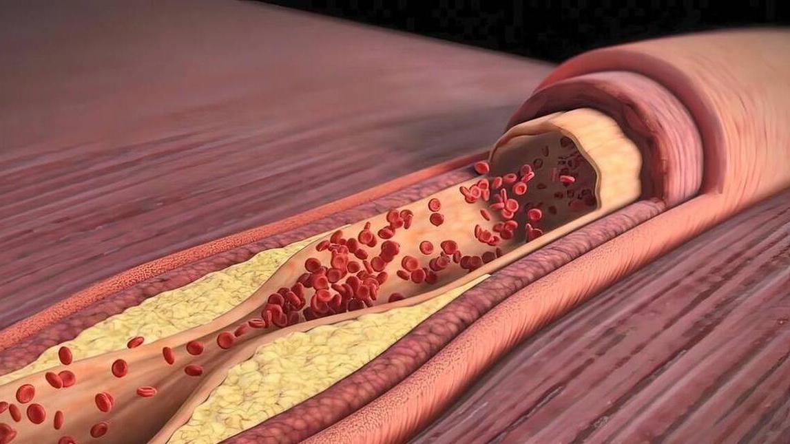 High blood pressure taking medicine for a long time, insist on taking