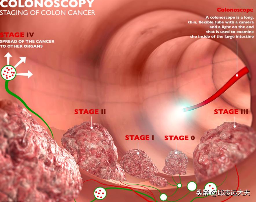 A study of more than 80,000 people shows that the role of the "gold