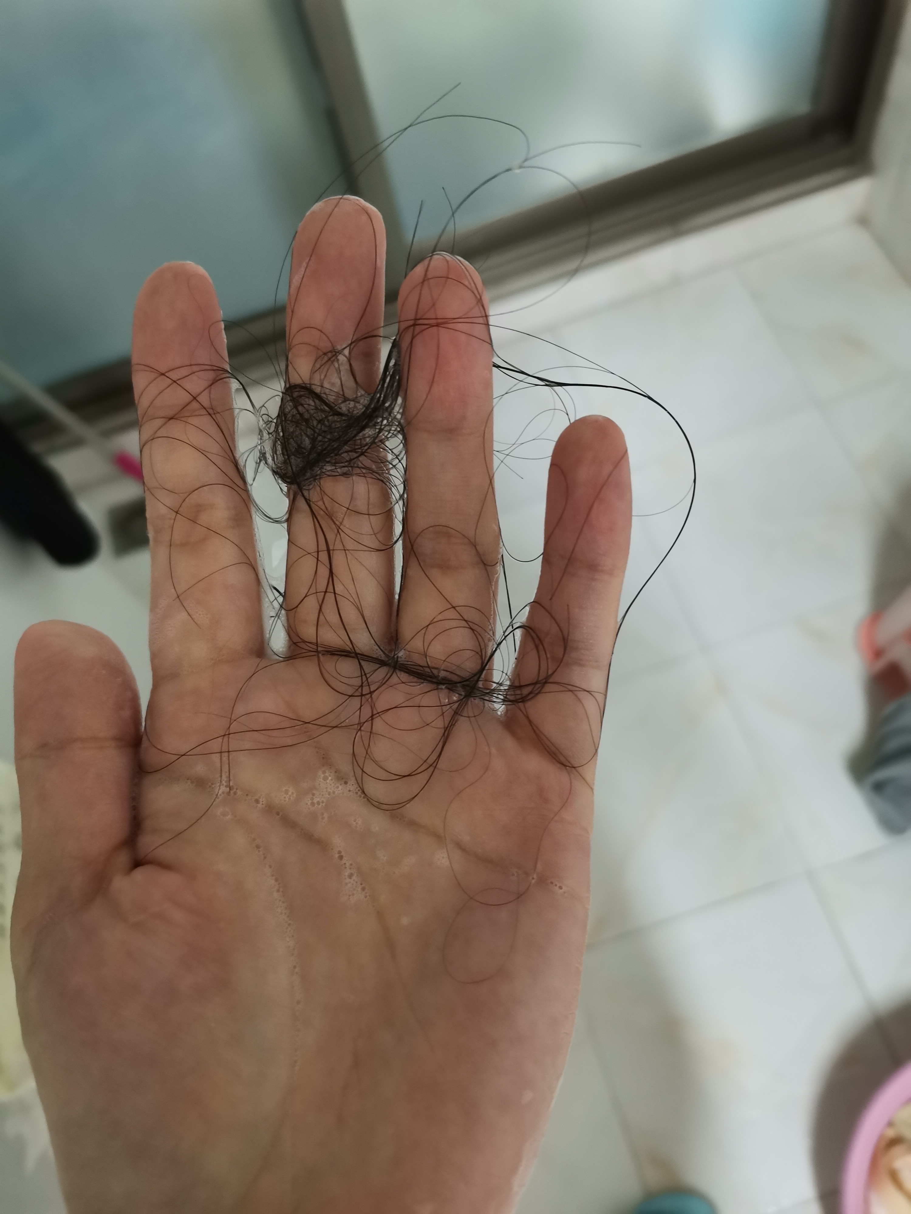 Ladies, have you also lost your hair after childbirth? iNEWS