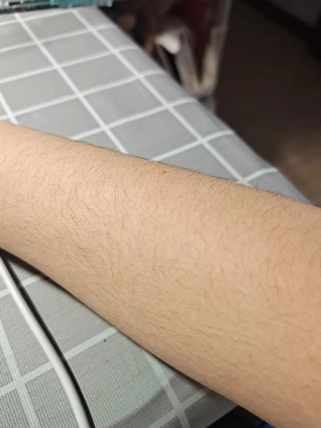 It turns out that using a depilatory cream is enough to get rid of arm