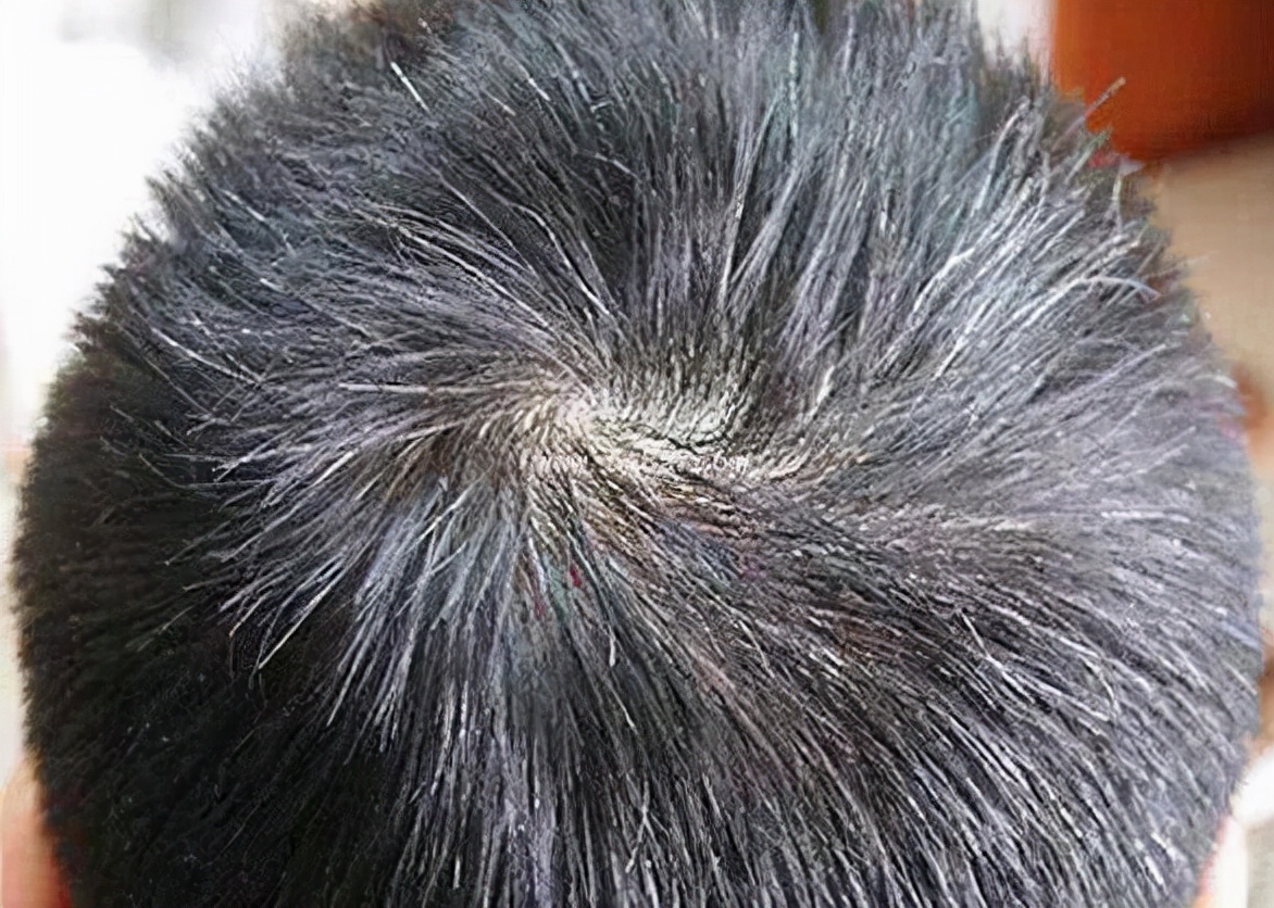 What do the forehead, temples, back of the head, and long white hair mean?  - iNEWS