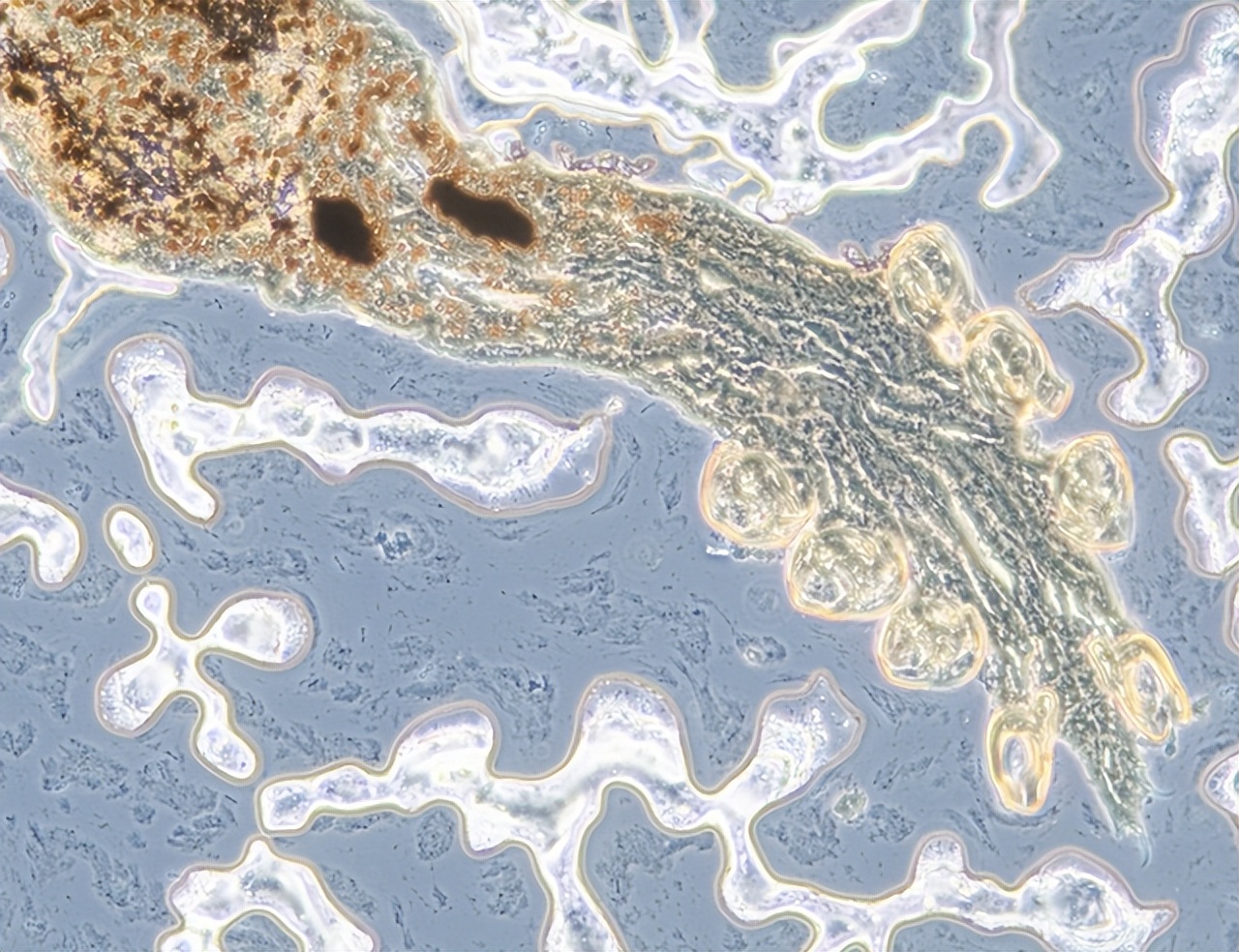 Four foods that contain "parasites", eat as little as possible iNEWS