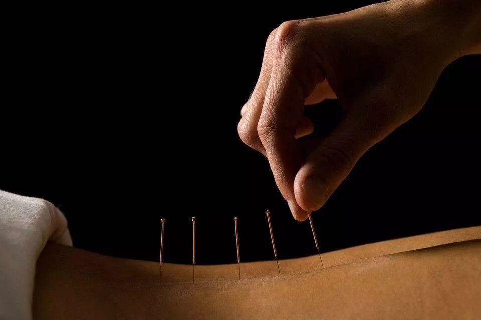 Acupuncture for the treatment of lumbar disc herniation iNEWS