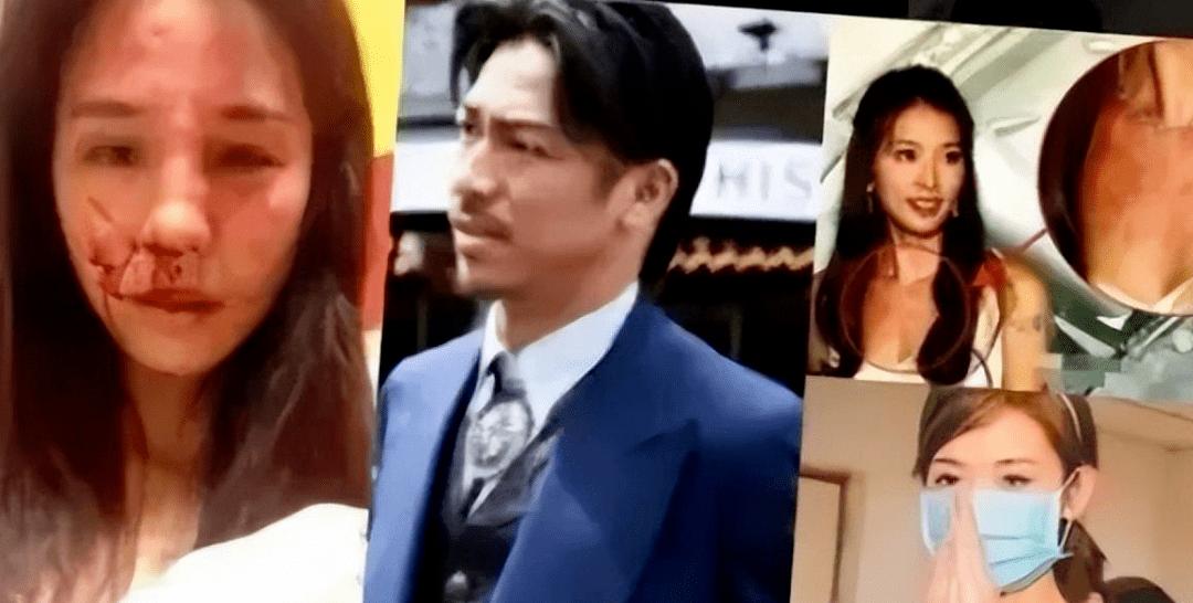 Lin Chiling suffered from depression and attempted suicide? Responding