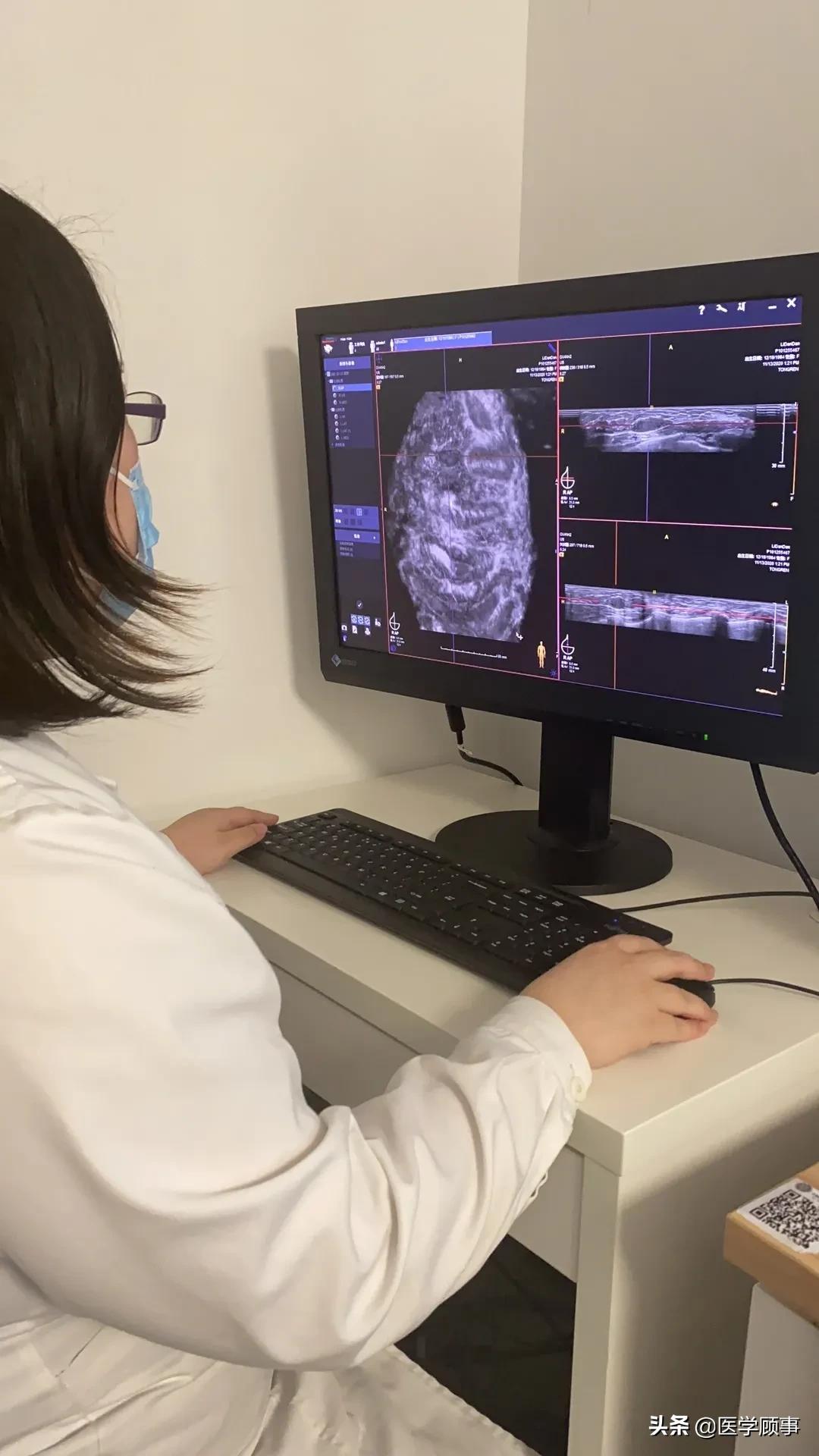 Automated Breast Volume Imaging (ABVS) for Breast Cancer Screening - iNEWS