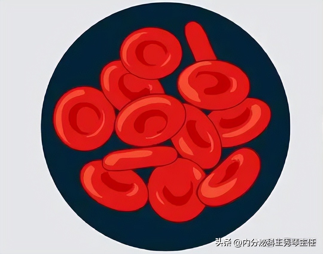 Teach you to understand in 1 minute, urine routine test sheet iNEWS