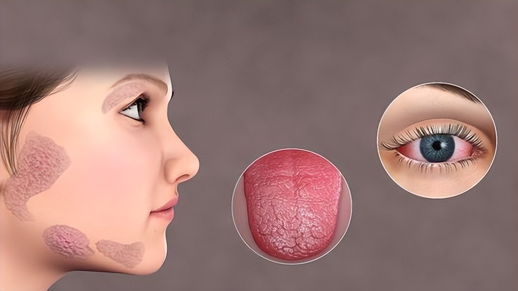 Is your mouth always "dry" at night?Is it because of lack of water?Or 5