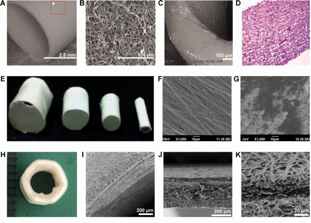 Biological preparation of small diameter tissue engineering vascular ...