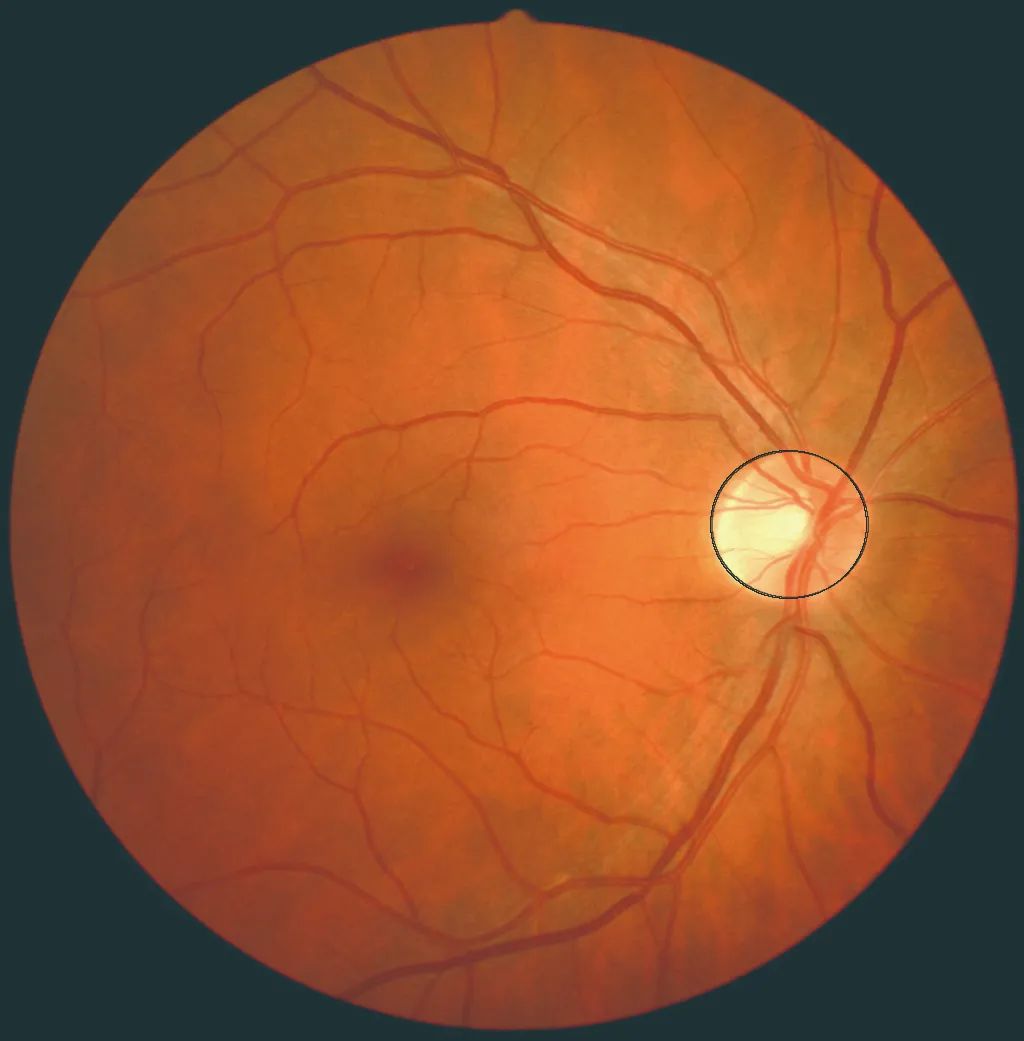 要想知道你眼睛的盲点所在,有一个简单的办法:闭上一只眼,用另一只眼