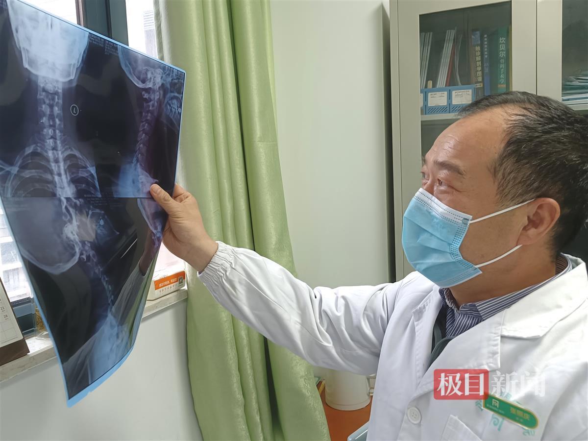 Open 8 mm incision to solve lumbar problems! "Pain Expert" Zhang